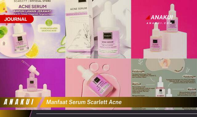 Inilah 10 Manfaat Serum Scarlett Acne yang Wajib Kamu Ketahui