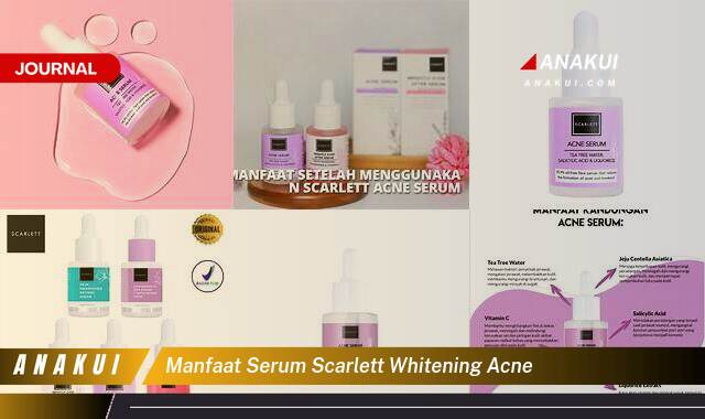 Ketahui 10 Manfaat Serum Scarlett Whitening Acne yang Tak Semua Orang Tahu