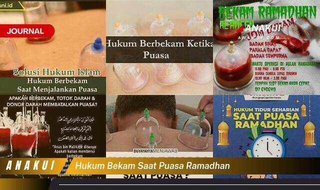 hukum bekam saat puasa ramadhan