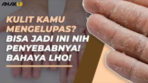 Kenapa Kulit Tangan Mengelupas